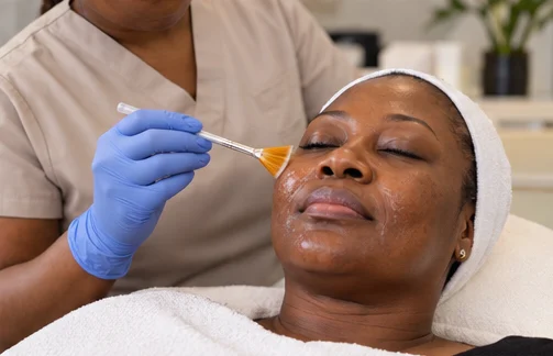 Gloved practitioner applying a chemical peel solution to a woman's face with a fan brush.